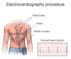 ELECTROCARDIOGRAPHY ( ECG )